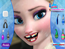 elsa dentist game