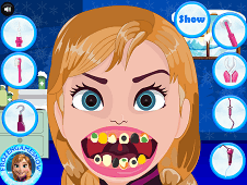 elsa dentist game